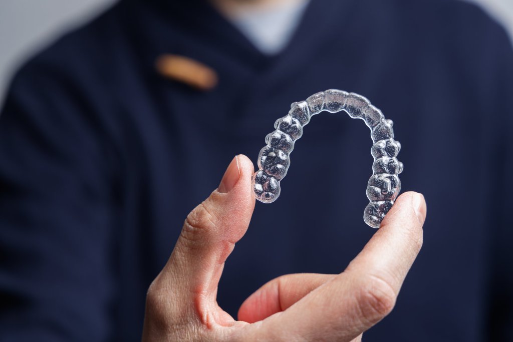 clear aligners Milton