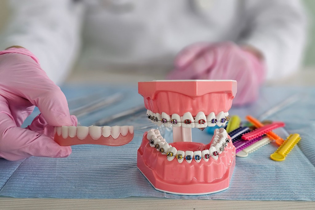 clear aligners in Ocean View